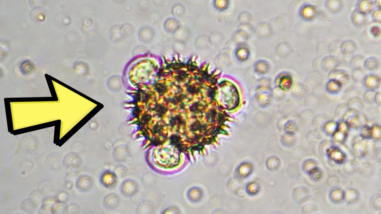 10 Bláznivých Věcí Spatřených Pod Mikroskopem