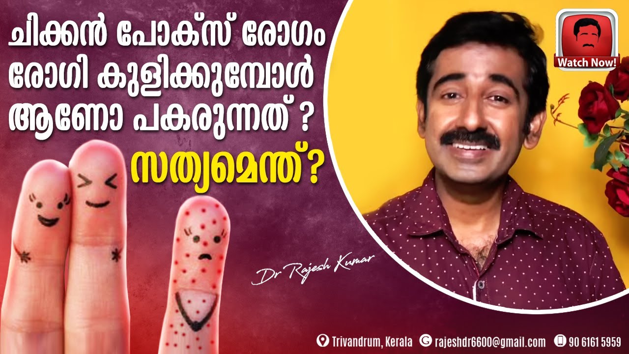 ചിക്കൻ പോക്‌സ് രോഗം രോഗി കുളിക്കുമ്പോൾ ആണോ പകരുന്നത് ? സത്യമെന്ത് ?