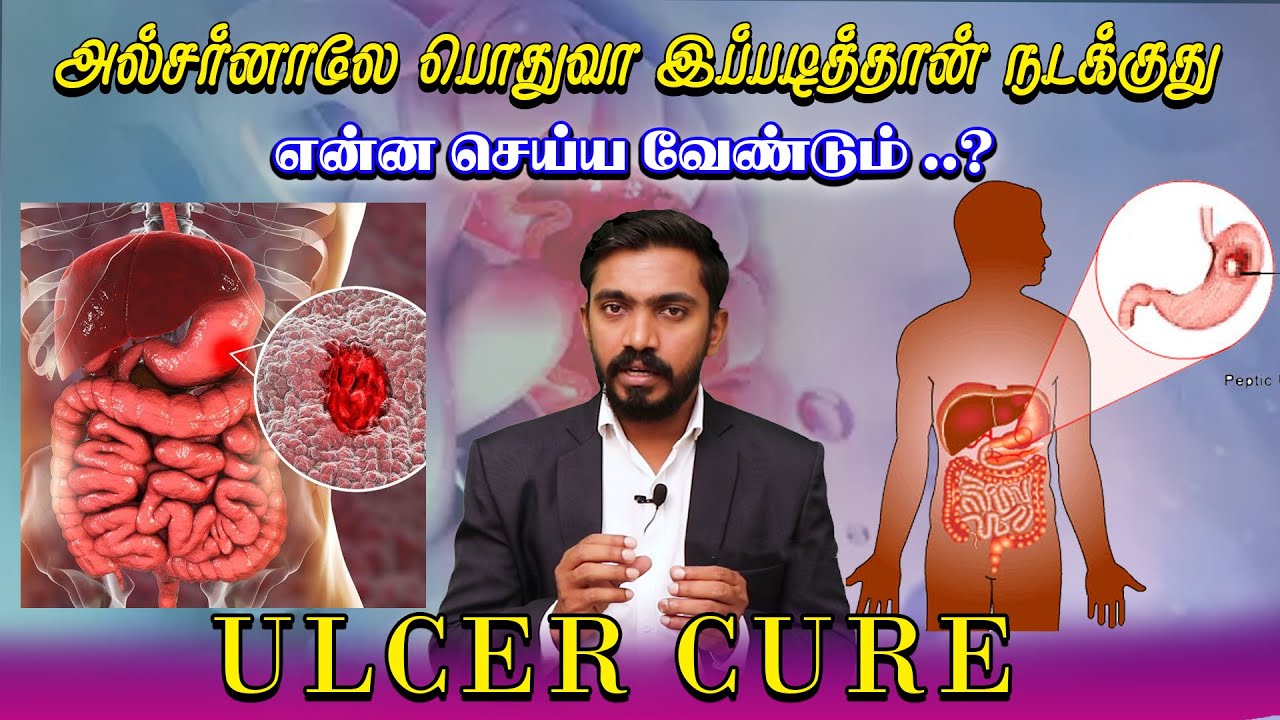 அல்சர் இருக்கா ? அப்போ தவறாமல் இதை பாருங்க | MUST WATCH FOR ULCER | DrSJ