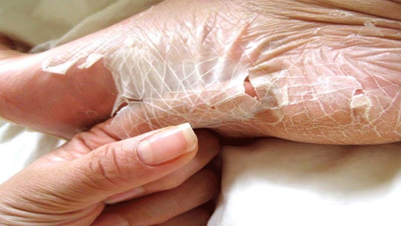 راجل عجوز بيقدر يتخلص من طبقات جلده كل يوم وبيرجع شباب في كل مره