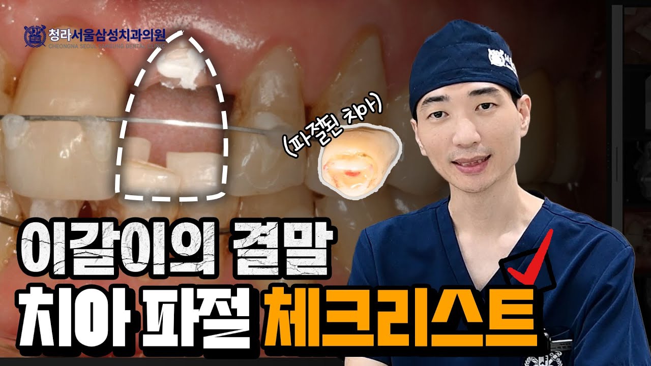 부러진 치아, 살릴 수 있을까? | 치아 파절 치료와 실제 사례ㅣ청라서울삼성치과