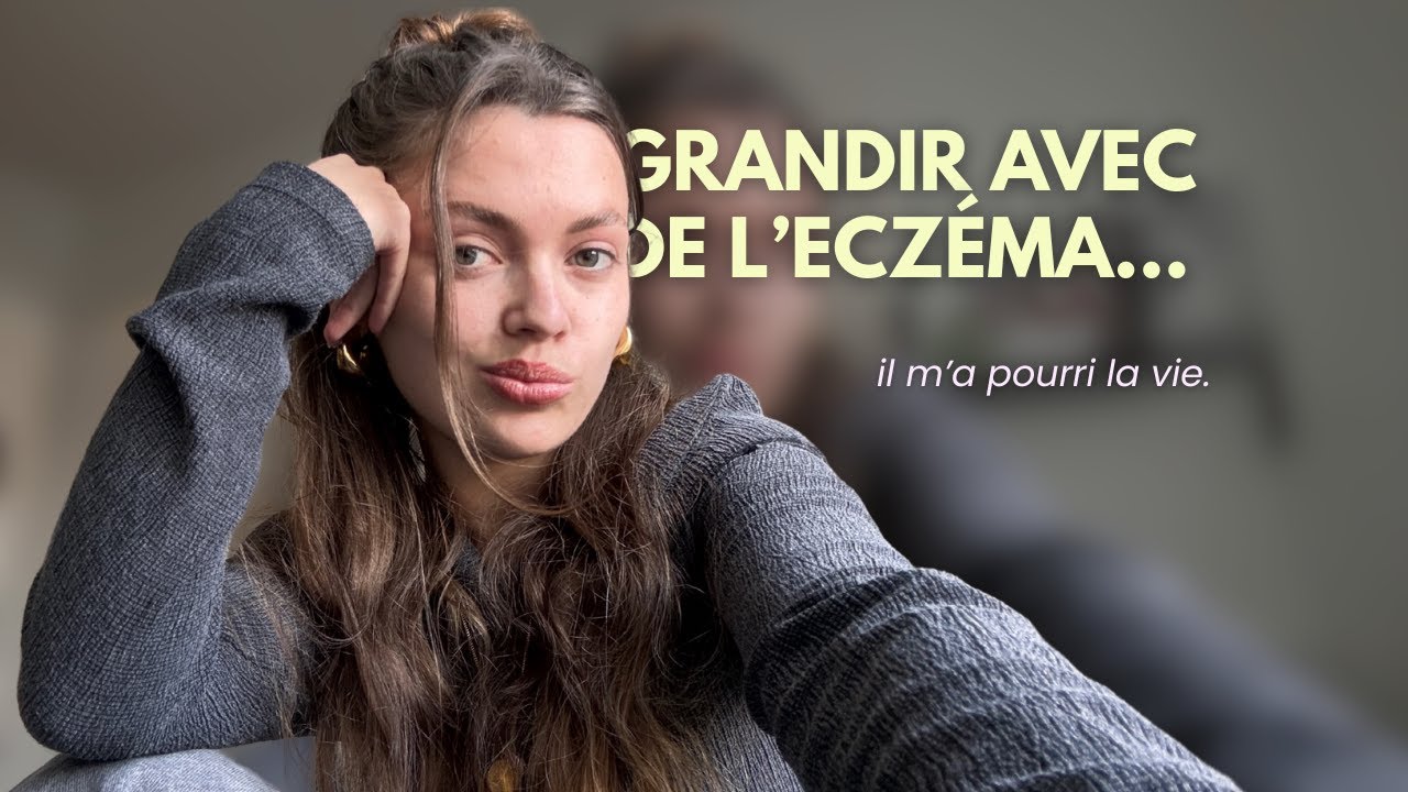 CHITCHAT COSY ☕ grandir avec de l'eczéma ; de la souffrance à l'acceptation ❤️‍🩹