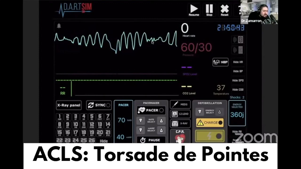 ACLS: Torsade de Pointes 🚨 🫀