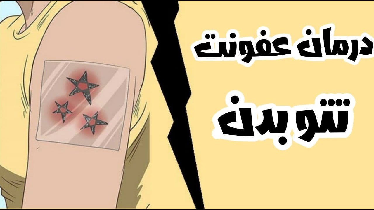راه درمان زخم های تتو