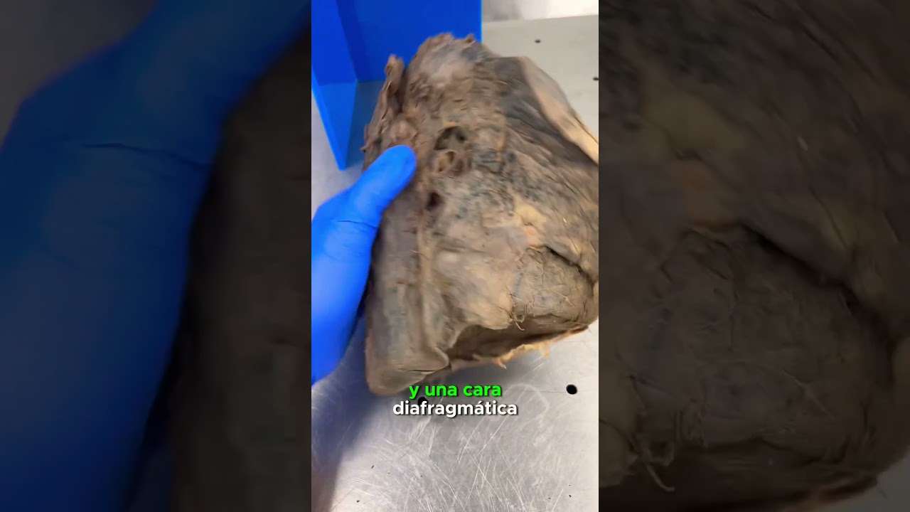 Pulmón izquierdo #pulmones #anatomia #medicina #elprofedeanato #fisioterapia #fypシ