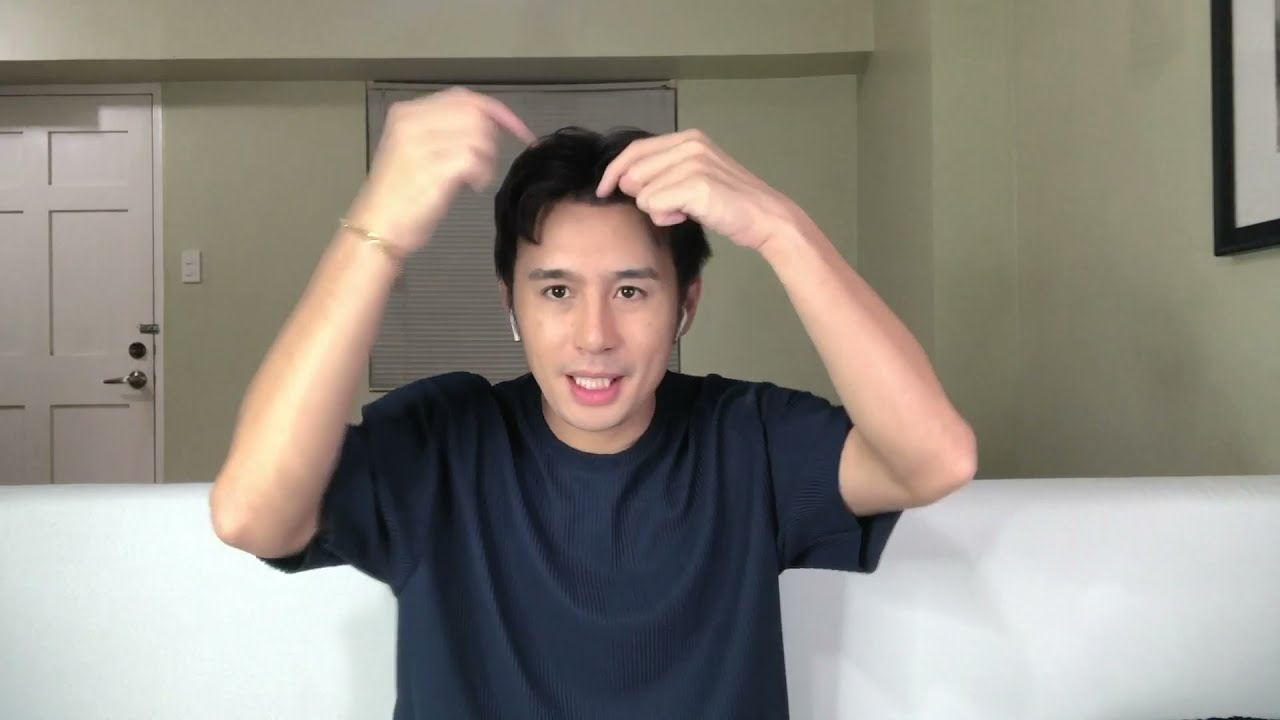 DHI Hair Transplant Journey-  Fifth Solomon