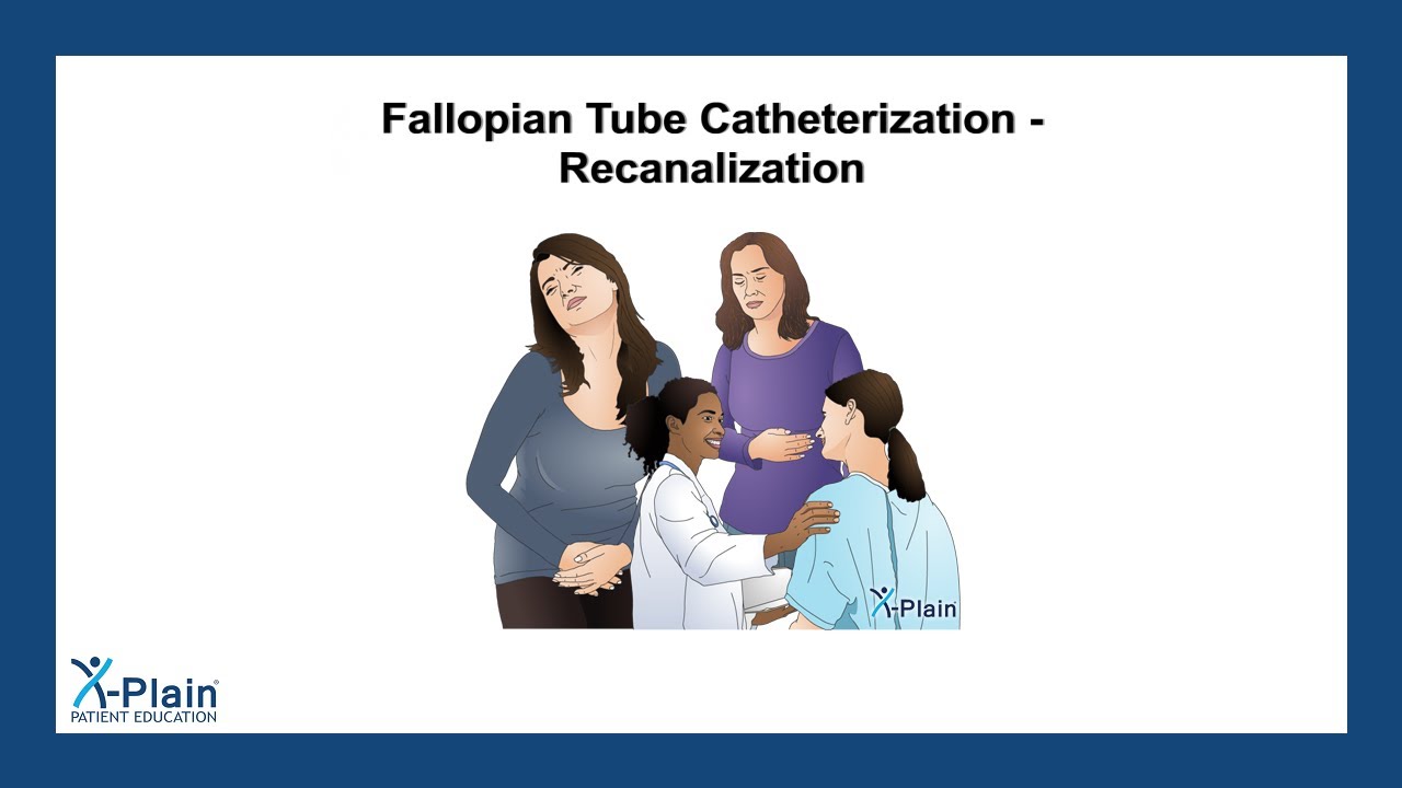 Fallopian Tube Catheterization - Recanalization