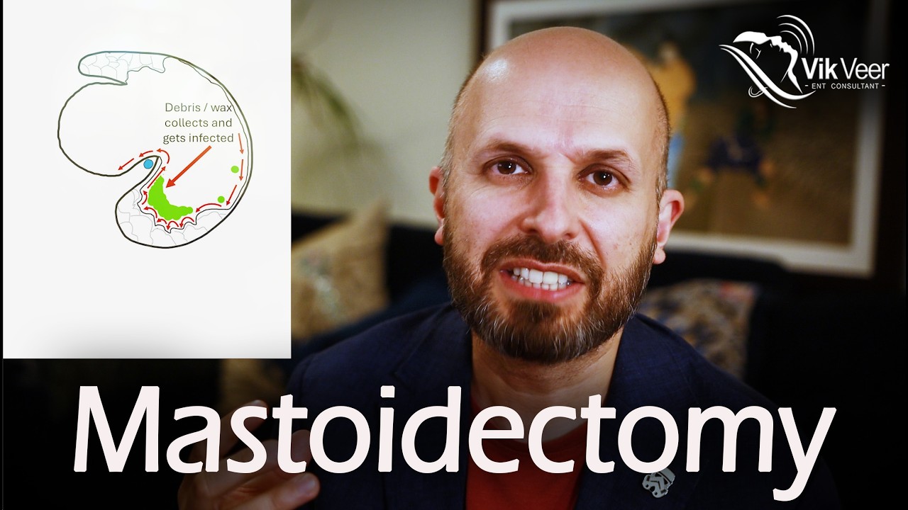 What is a Mastoidectomy (canal wall UP Vs Down}