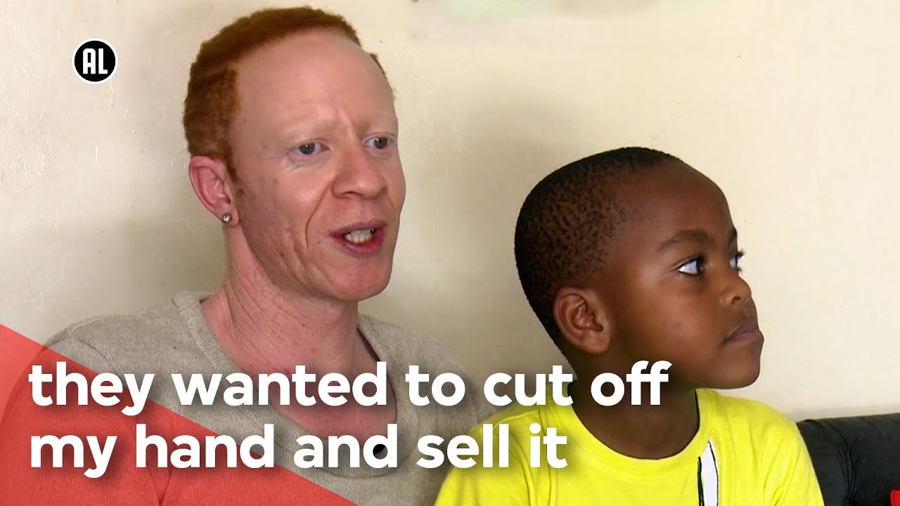 Albino in Kenya | VPRO Metropolis
