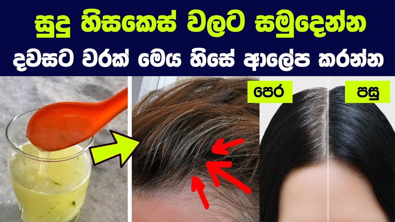 සුදු කෙස් වලට සමුදෙන්න,දවසට වරක් මෙය හිසේ ආලේප කරන්න | Say Goodbye To White Hair