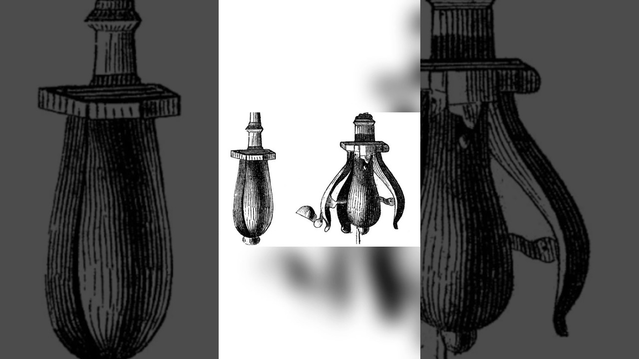 The Pear of Anguish