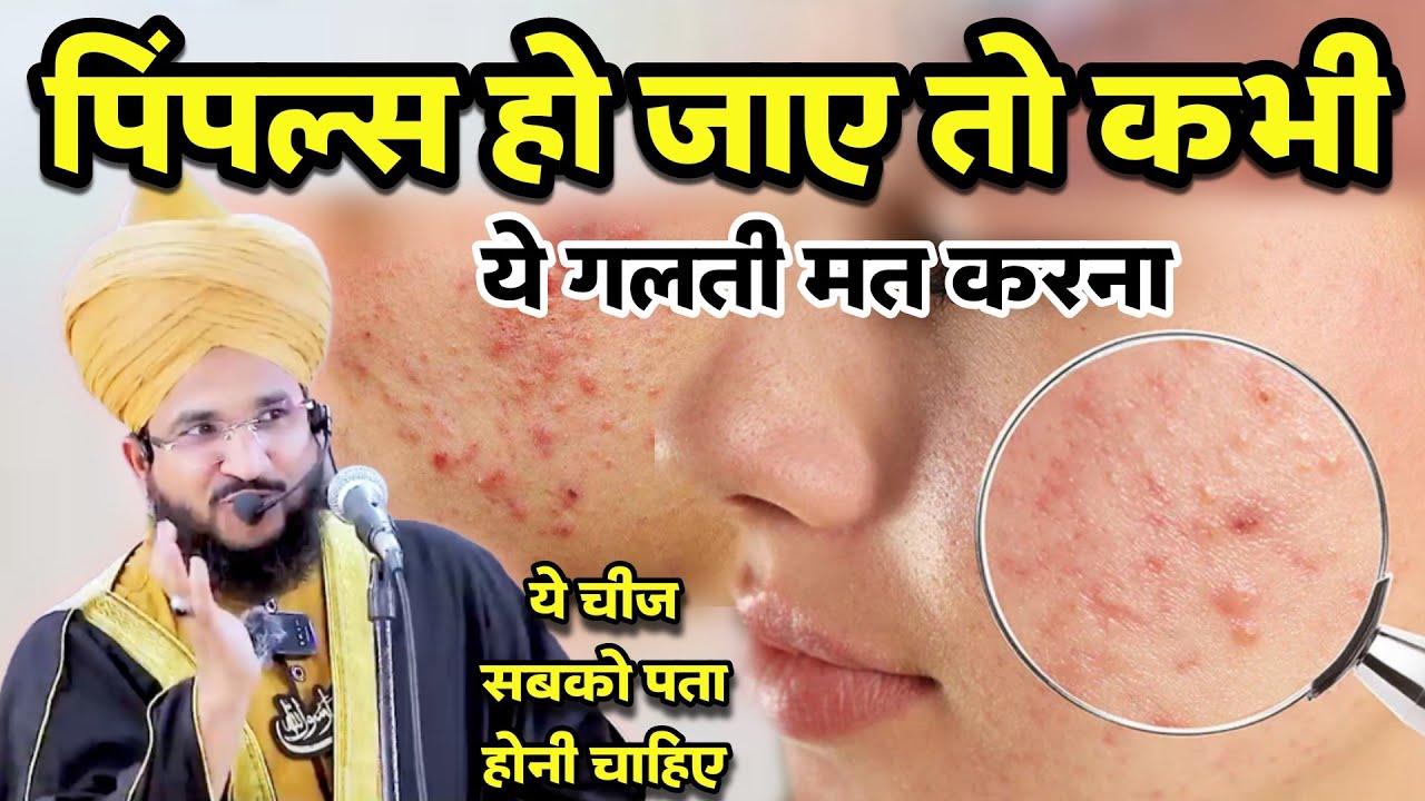 Pimples Ke Hawale Se Ye Cheez Sab Ko Pta Honi Chahiye | Mufti Salman Azhari