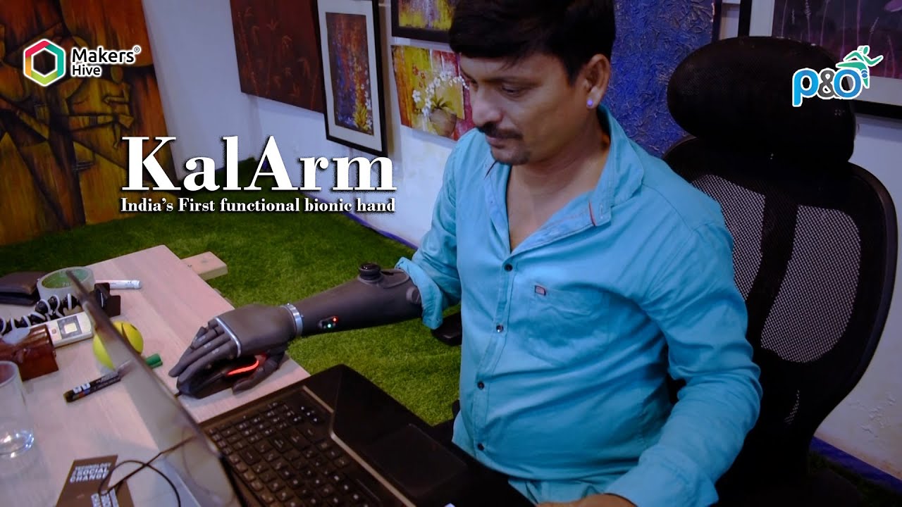 KalArm (India’s First functional bionic hand)