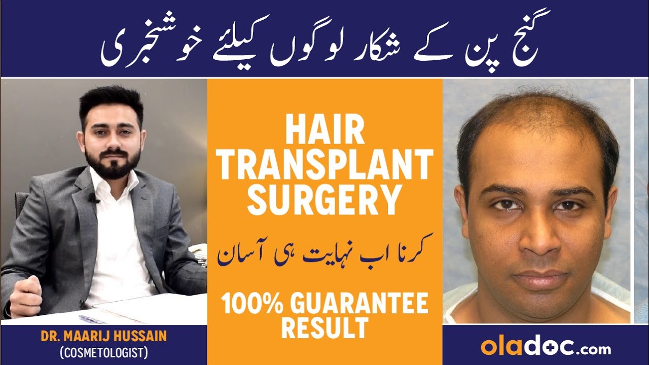 Hair Transplant Kaise Hota Hai - Ganjpan Kaise Dur Karen - Baldness Treatment For Men In Urdu/Hindi