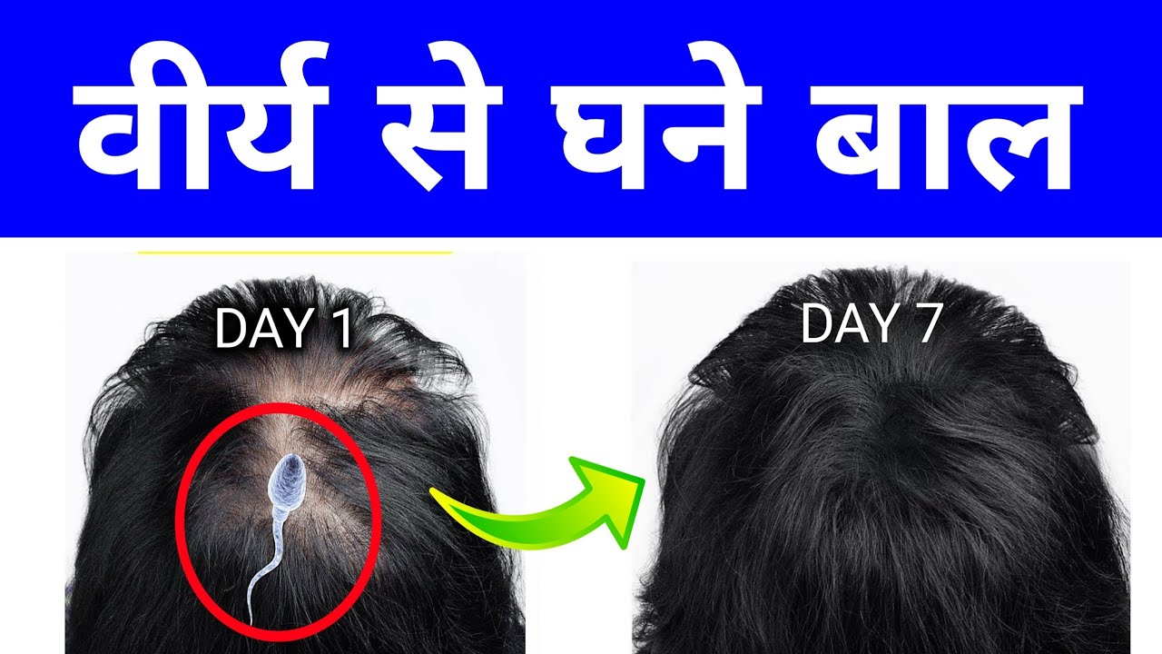 Magical Hair Regrowth from Brahmacharya 🔥 | Must Watch