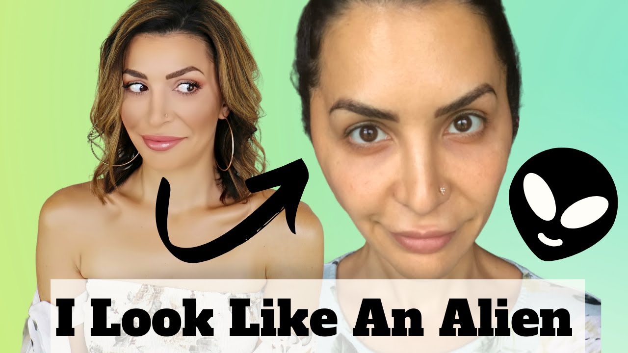 Female Hair Transplant Recovery | 2 weeks Post Op | The Good, Bad & REALLY UGLY