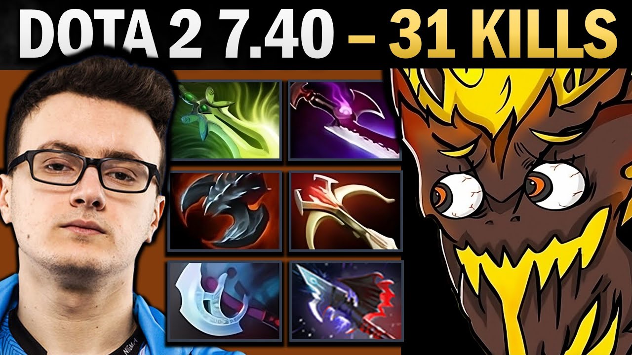 Shadow Fiend Pro Carry with 31 Kills and Manta - Gameplay Dota 2