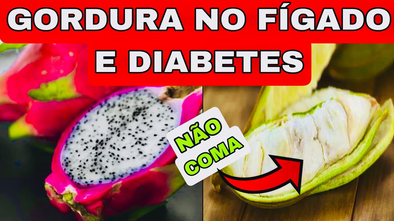 10 MELHORES FRUTAS para GORDURA NO FÍGADO e DIABETES (e também as 5 PIORES)