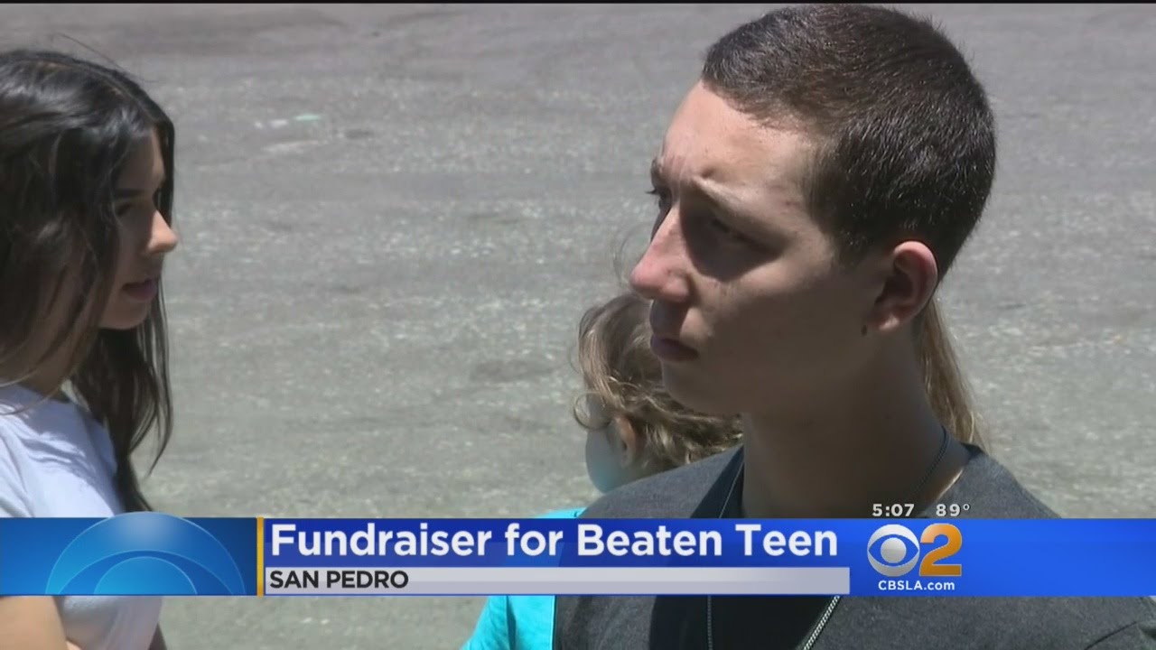 Fumdraiser Held For Badly-Beaten San Pedro High School Baseball Player