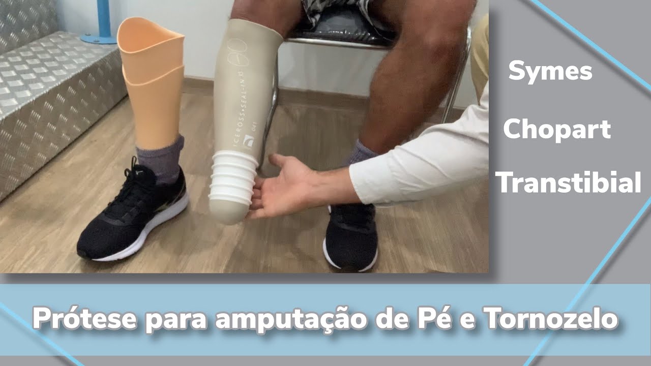 Prótese para amputação de pé e tornozelo (Symes, Chopart, Transtibial)