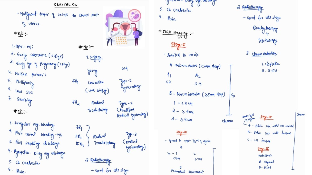 CARCINOMA CERVIX | GYNECOLOGY | ONE PAGE NOTES | 4TH PROFF | MBBS