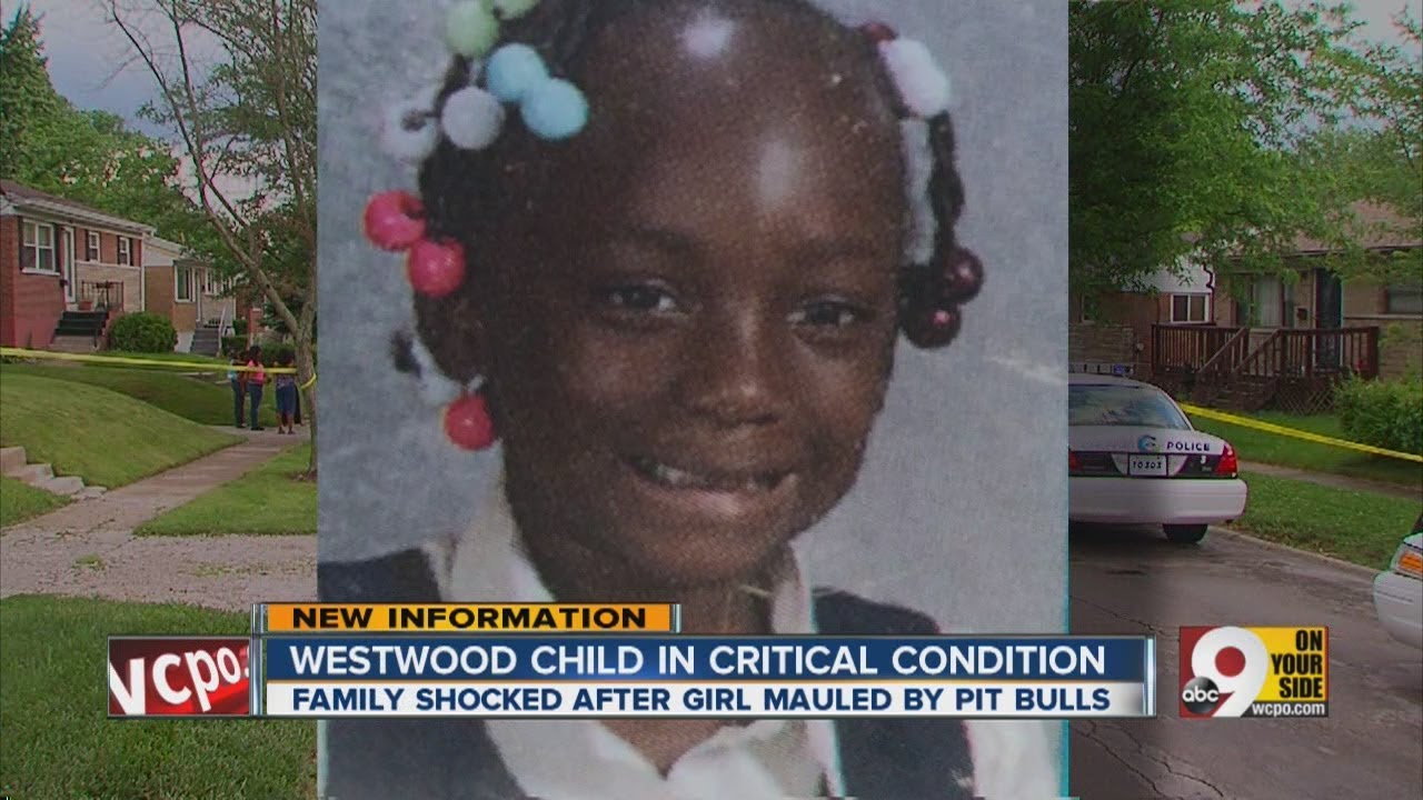 911 call: 'There's a pit bull eating a baby'
