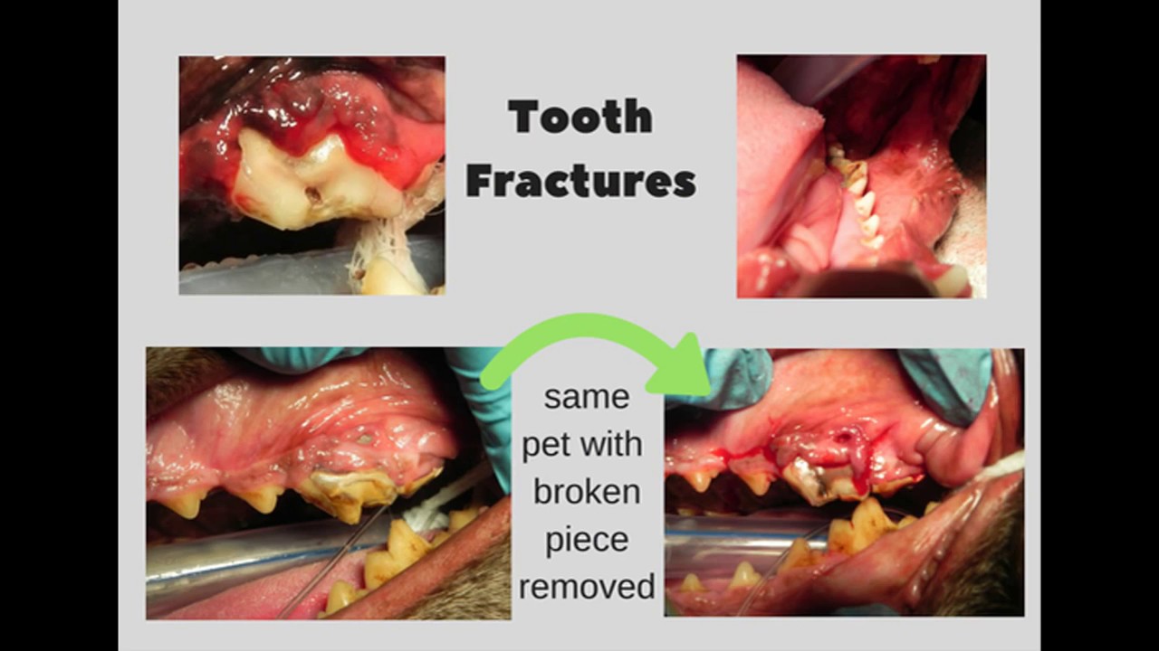 Broken Tooth - More Common Than You Might Think!