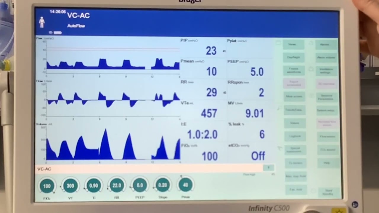 Ventilator (Drager Infinity C500) Part 4 - Adjusting Settings and Troubleshooting