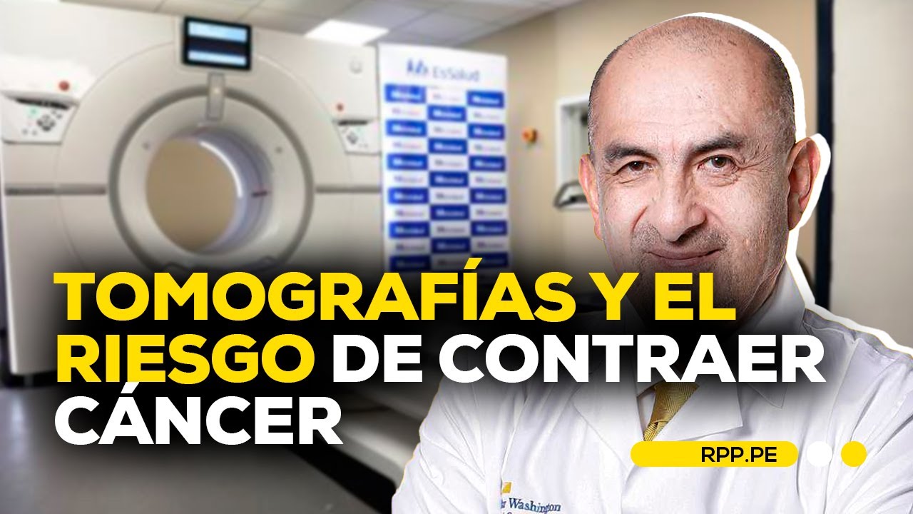 ¿Las tomografías son un riesgo para la salud? Dr. Elmer Huerta explica | Espacio vital