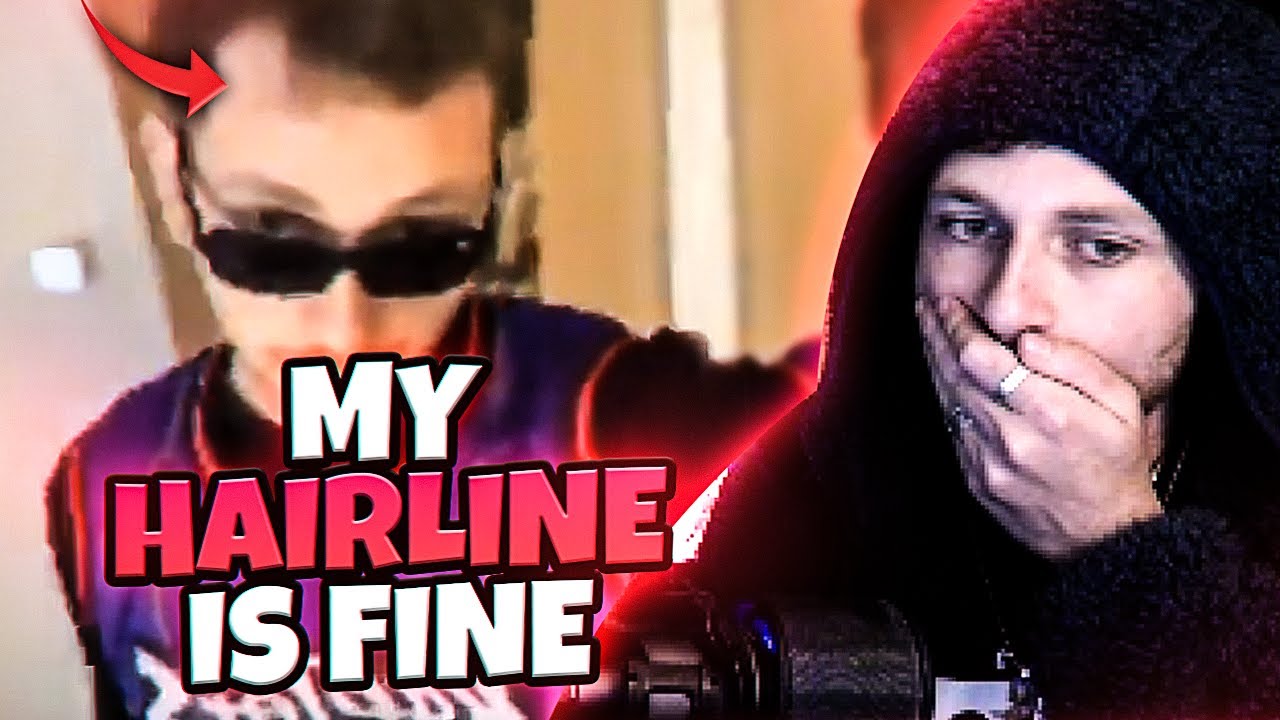 I swear my hairline is fine... [Tik Tok Stream Highlights]