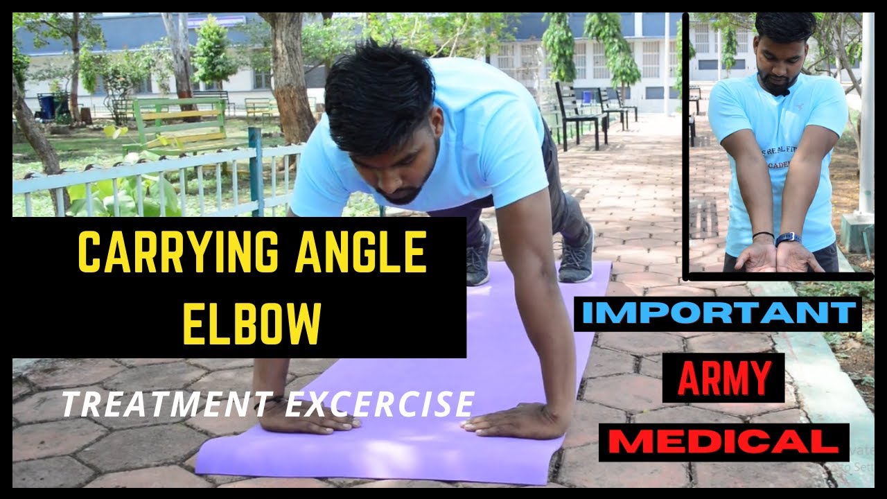 Carrying Angle Elbow Exercises In Hindi, How To Check Carrying Angle Of Elbow At Home Cubitus valgus