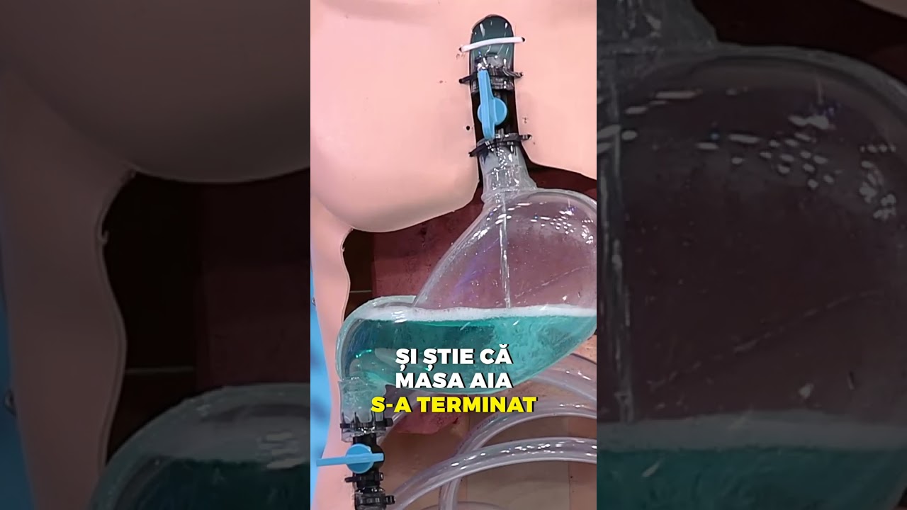 STRESSUL si DIGESTIA 🤔 🩻👨🏼&zwj;⚕️