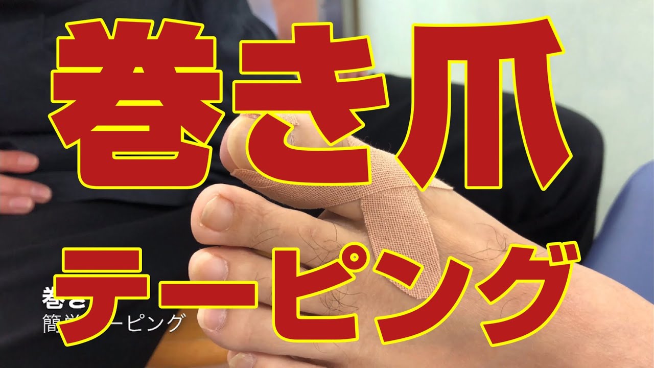 巻き爪の簡単テーピング