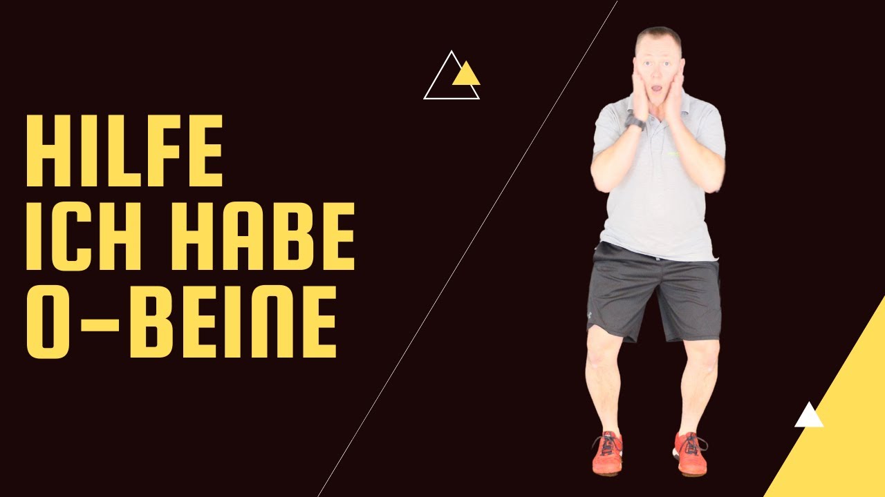 O-Beine, 3 einfache Übungen
