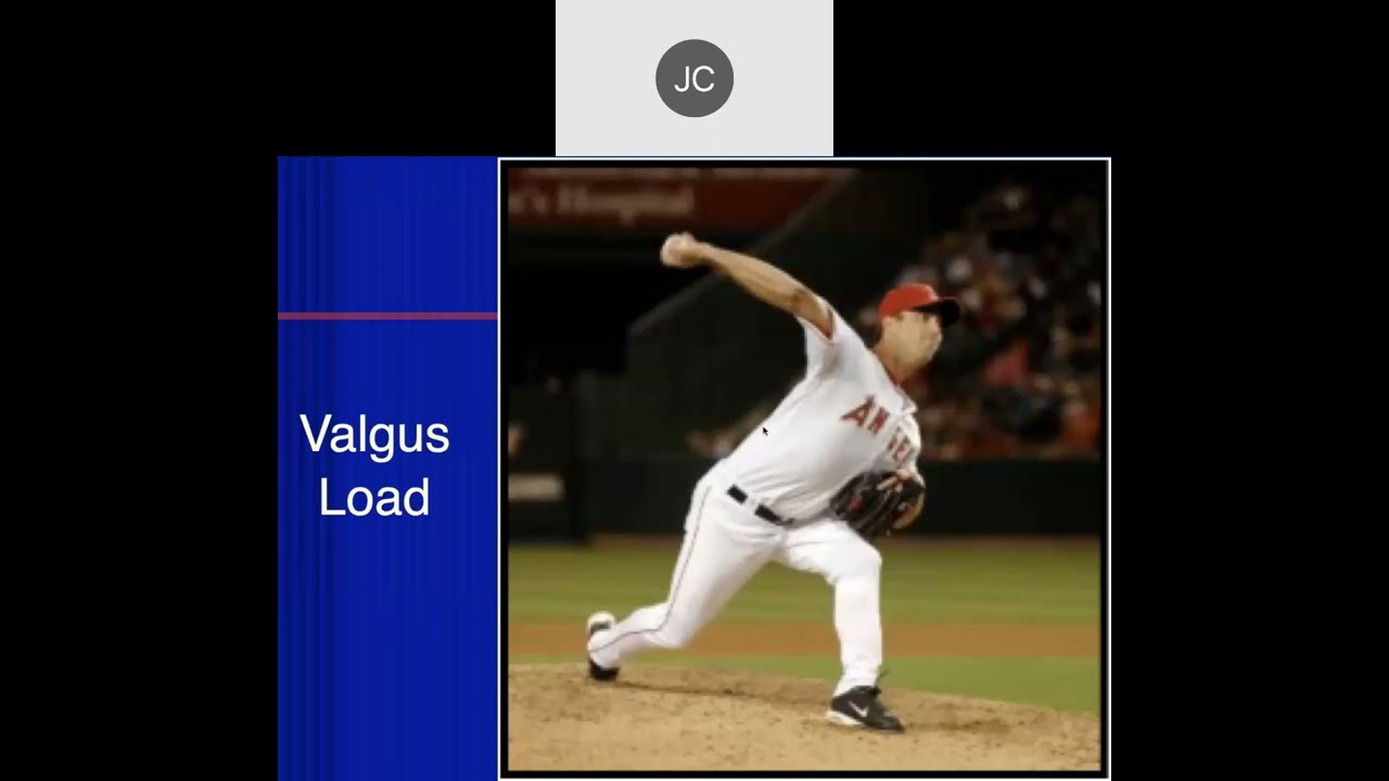 Elbow Part 1: Elbow T&L