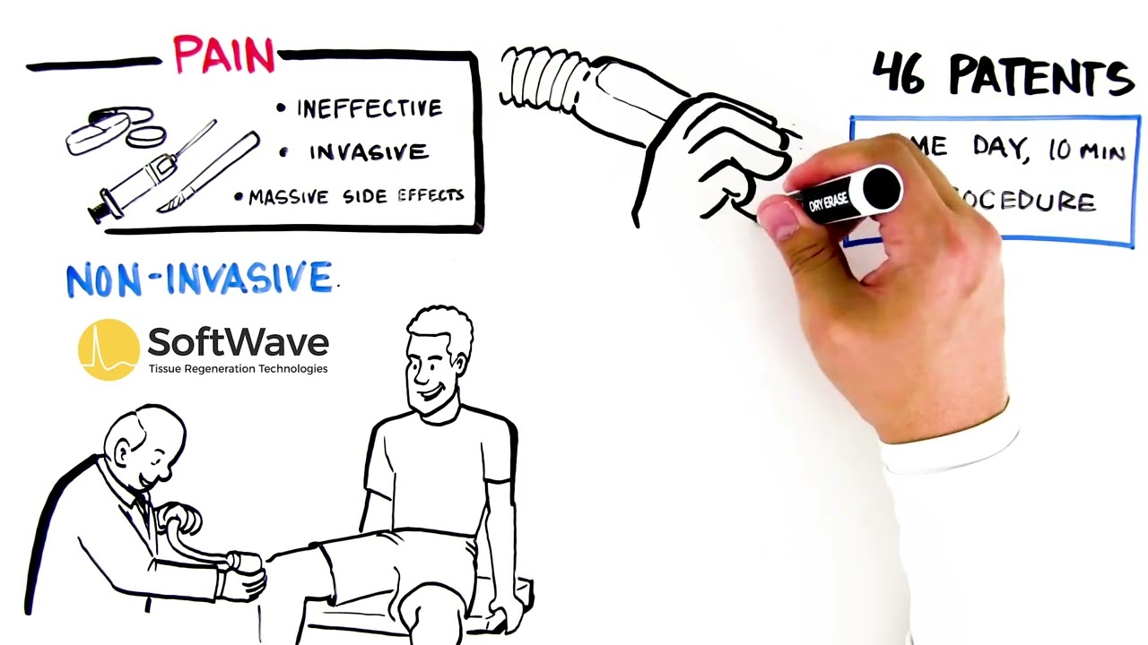 What is SoftWave (animated)