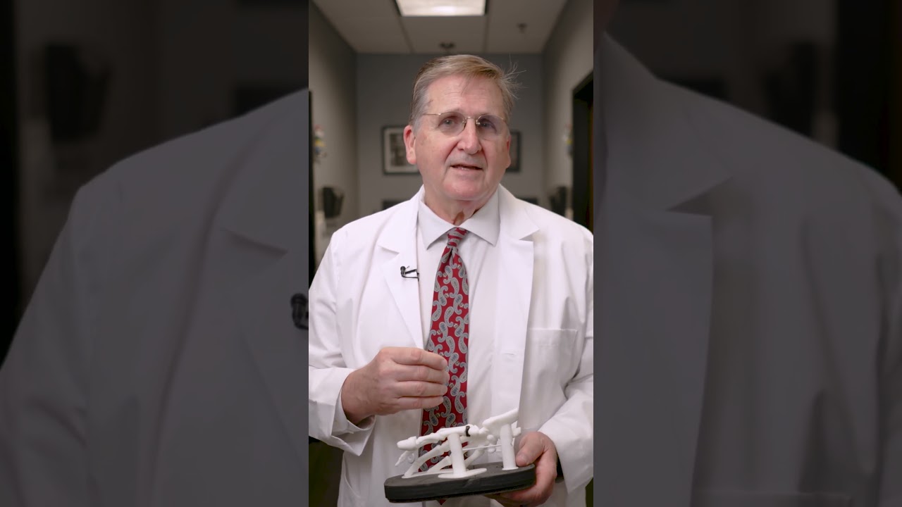 Thumb Replacement? Meet the Ensemble Implant #jointreplacement