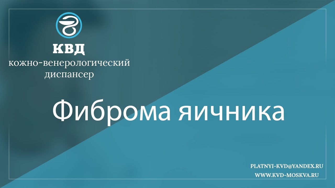 1015  Фиброма яичника