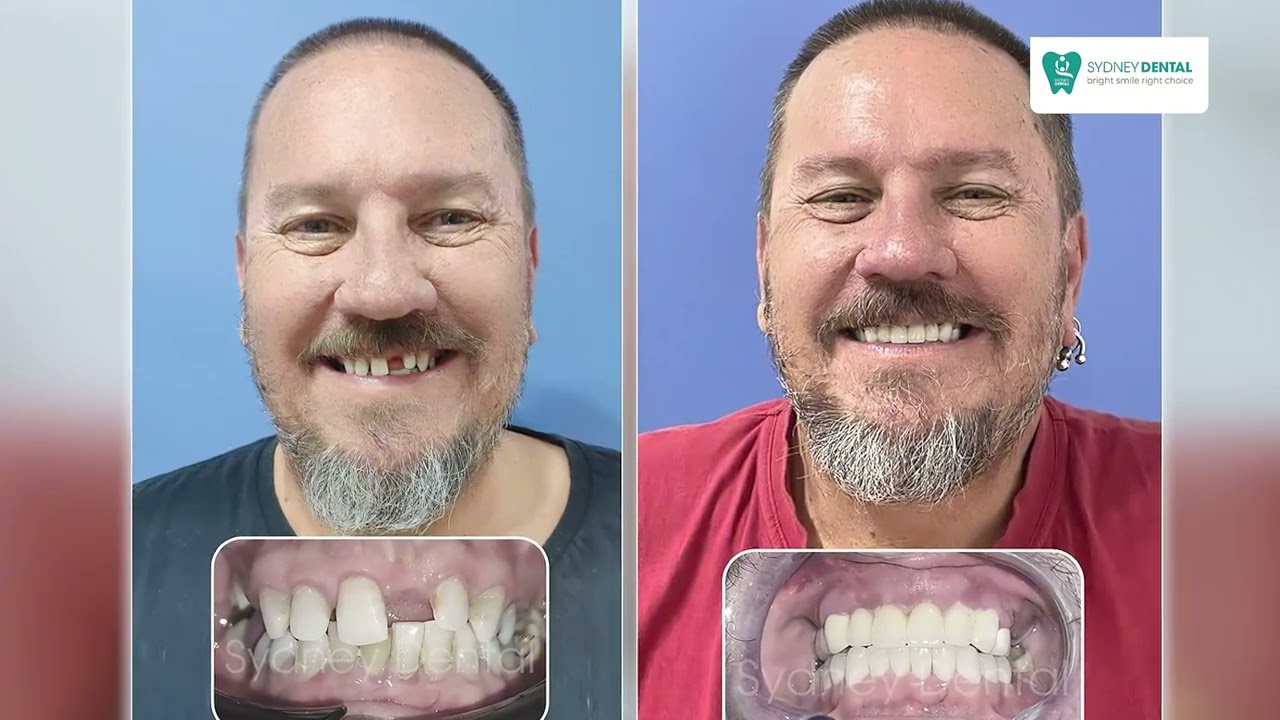Why Dental Tourism in Vietnam is the Perfect Choice | Sydney Dental Clinic #dentaltourism