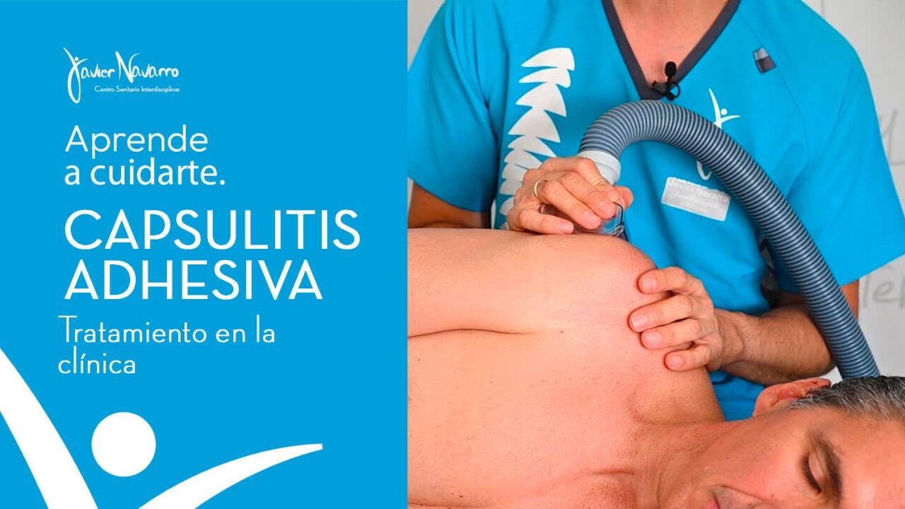 ¿Tengo Hombro Congelado o Capsulitis Adhesiva? ¿Cómo tratarlo?