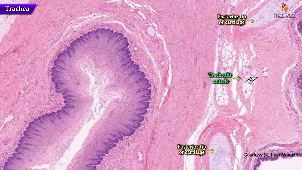 Histology of trachea - Shotgun Histology