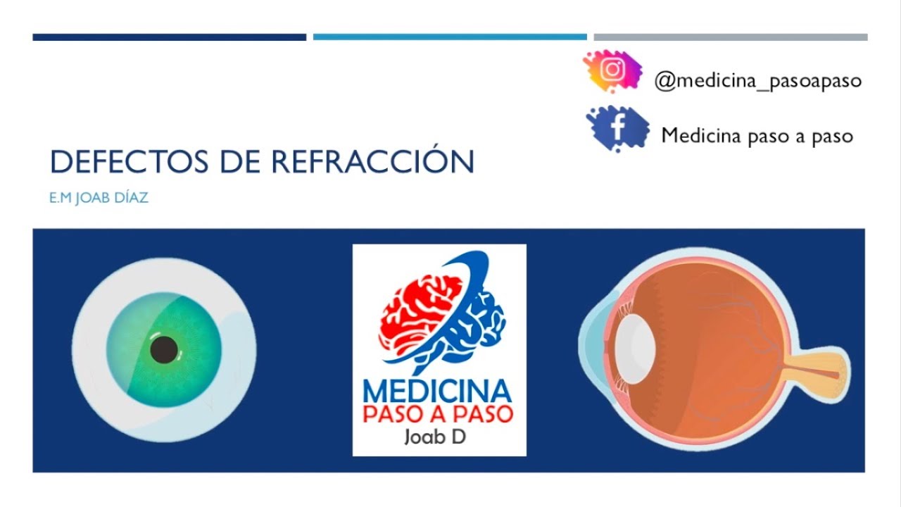 Oftalmología. Ametropias. Miopía, Hipermetropía, Astigmatismo