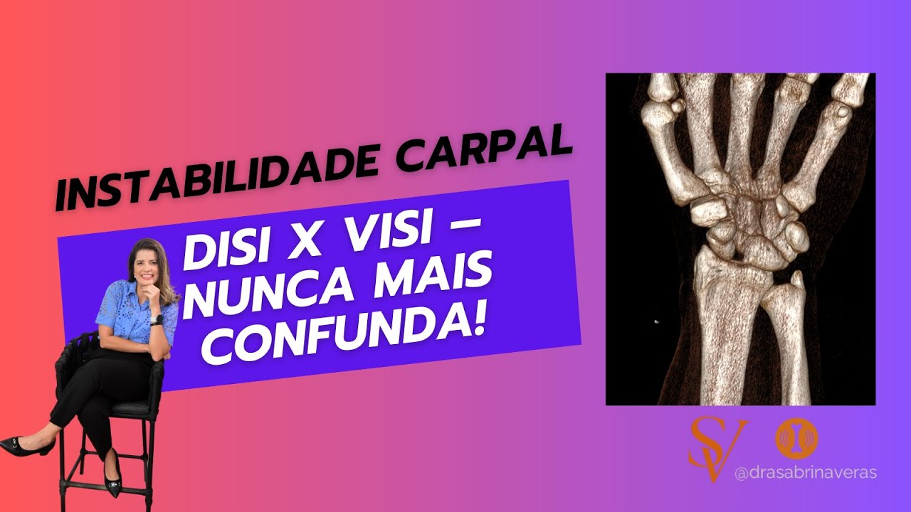 Instabilidade Carpal: DISI e VISI na Pr&aacute;tica