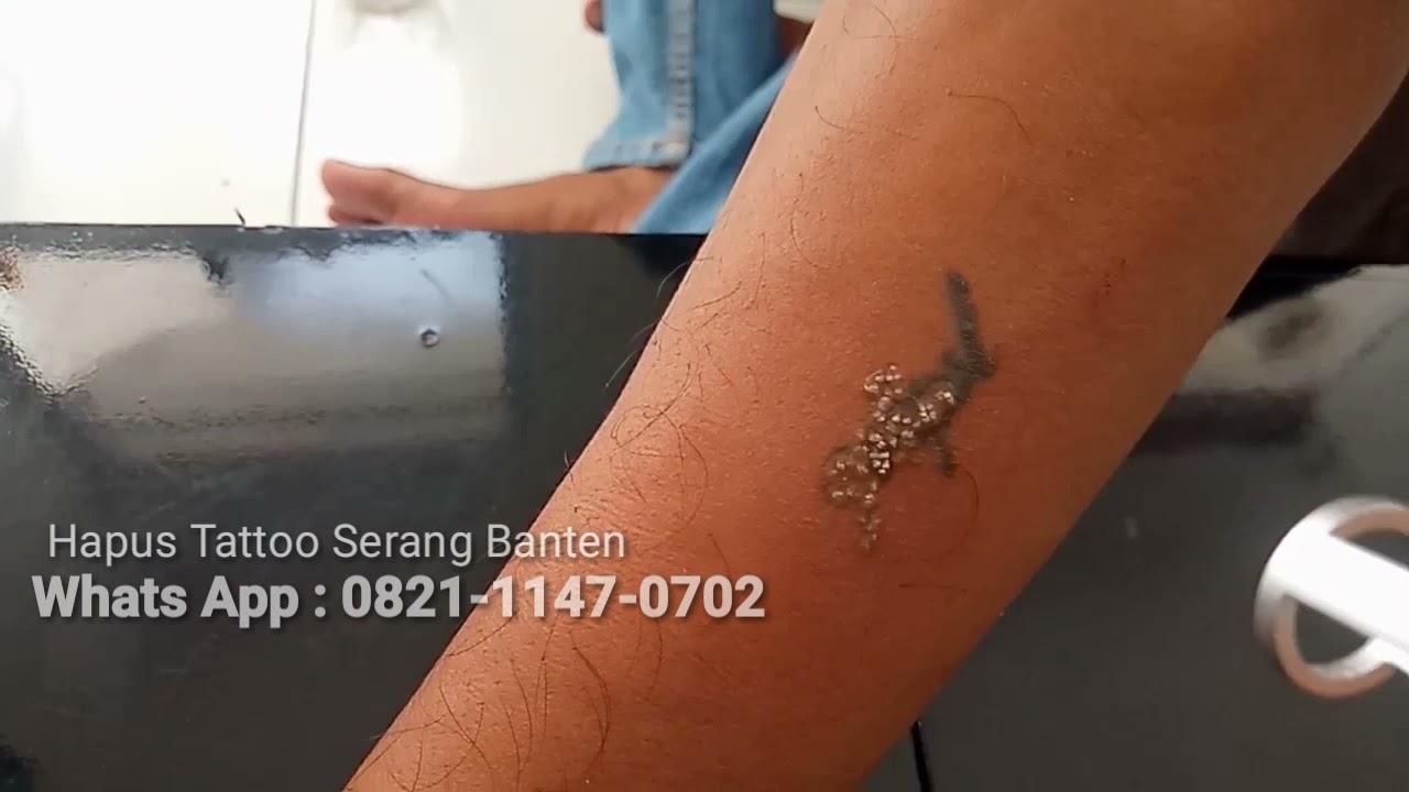 Hapus Tattoo 2022