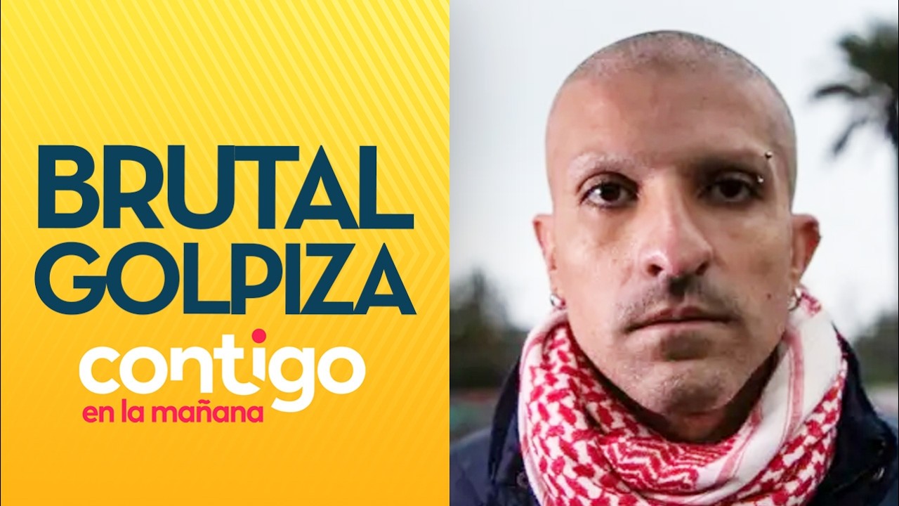 MANIATADO Y ROCIADO CON BENCINA: Rojas Vade quedó en riesgo vital por golpiza - Contigo en la Mañana