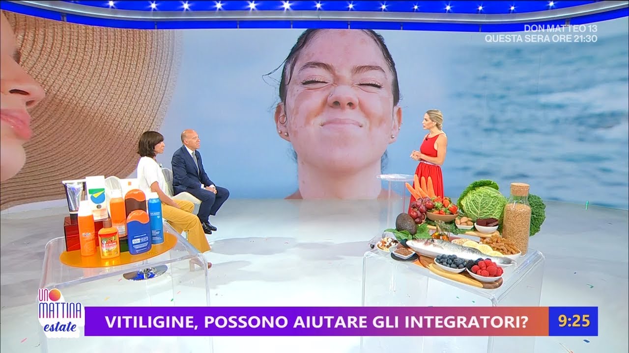 Abbronzatura e vitiligine: le regole del sole sicuro - Unomattina estate 26/06/2025