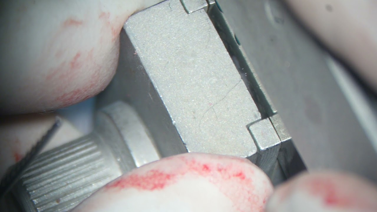 Conchal cartilage harvesting