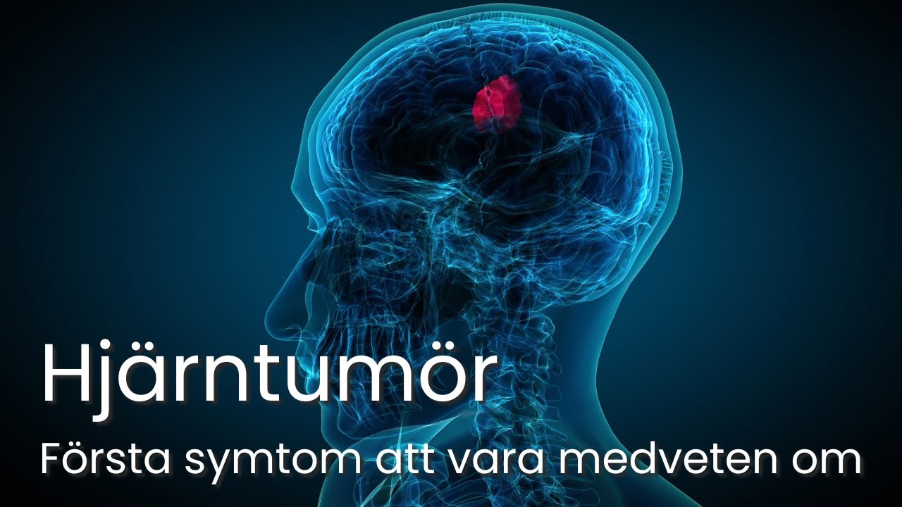 Hjärntumör – Första symtom & tecken att vara uppmärksam på