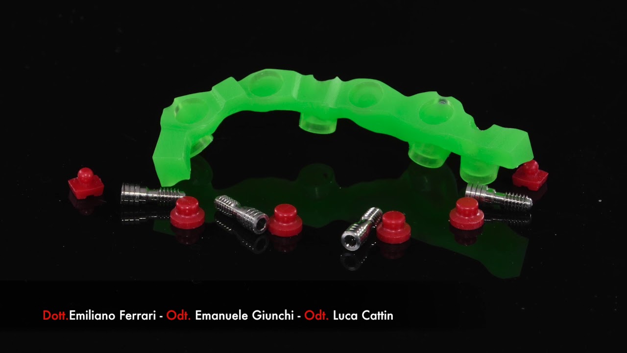 Project digital overdenture with OT Cap Tecno DR E. Ferrari, E.Giunchi, L.Cattin