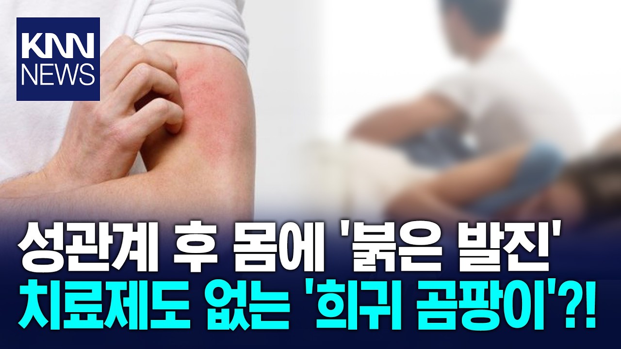 단순 습진인 줄 알았는데 '초비상' 성관계로 전파되는 '희귀 곰팡이'/ KNN